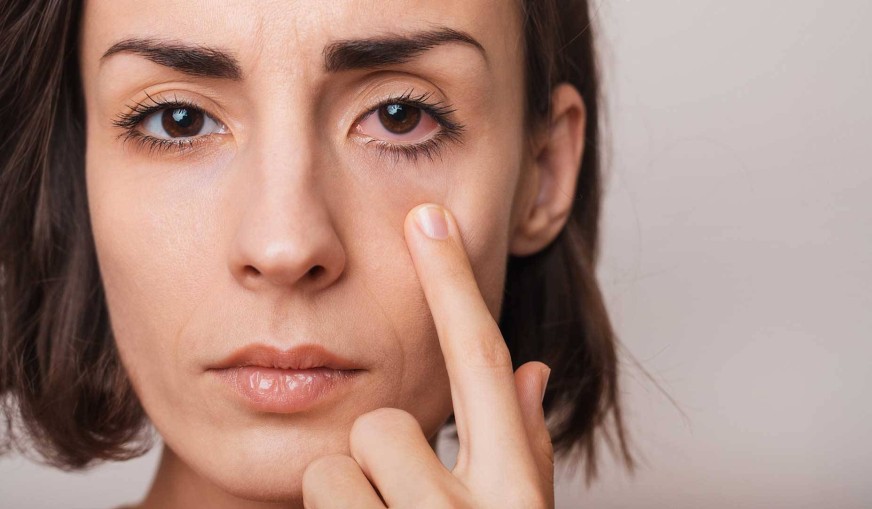 A Vitamini Eksikliği ve Göz Sağlığı Üzerindeki Etkileri