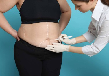 Bariatrik Cerrahi Sonrası İlk Haftalarda Beslenme