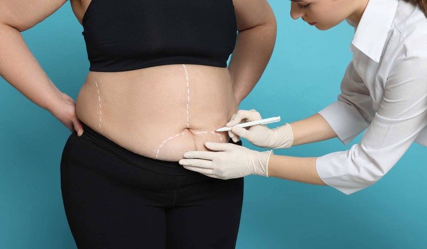 Bariatrik Cerrahi Sonrası İlk Haftalarda Beslenme