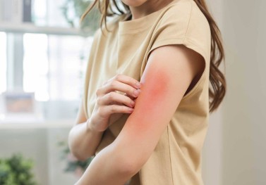 Besin Alerjileri ve İntoleransları: Beslenme Planınızı Nasıl Uyarlarsınız?