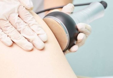 Bölgesel Zayıflama İçin Cihazlar İşe Yarıyor mu?