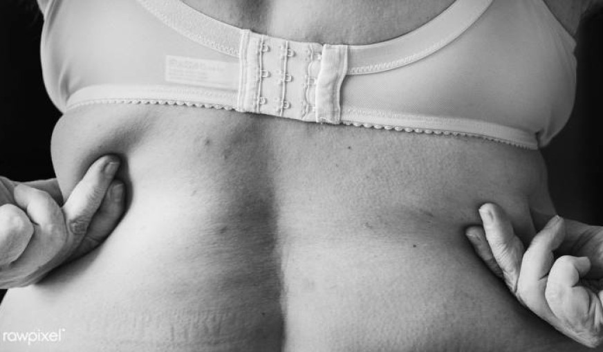 Cihaz ile Bölgesel Zayıflama