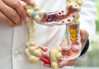 Crohn Hastalığı Beslenmesi: Alevlenme ve Remisyonda Ne Yemeli?
