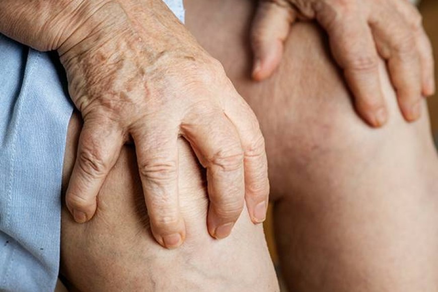 Nutrition for Gout