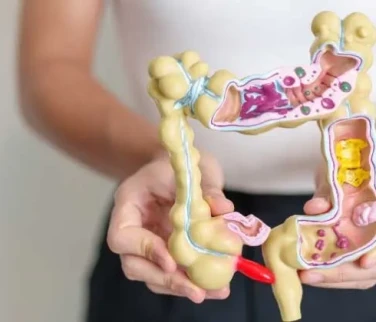 İrritabl Bağırsak Sendromu (IBS) İçin Beslenme Planı