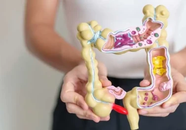 İrritabl Bağırsak Sendromu (IBS) İçin Beslenme Planı