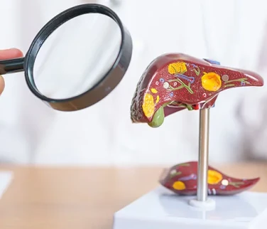 Karaciğer Yağlanması İçin Bilimsel Beslenme Önerileri