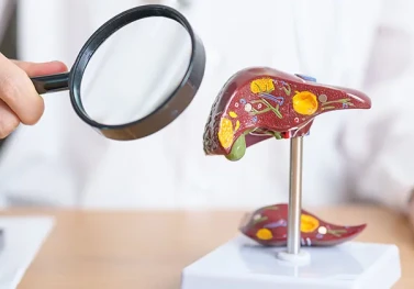 Karaciğer Yağlanması İçin Bilimsel Beslenme Önerileri