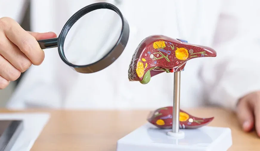Karaciğer Yağlanması İçin Bilimsel Beslenme Önerileri