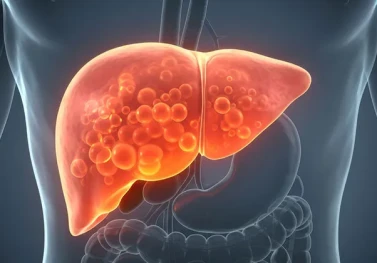 Karaciğer Yağlanması ve Beslenme: Sağlıklı Bir Kılavuz