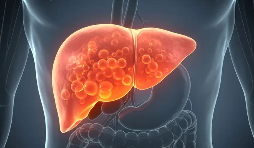 Karaciğer Yağlanması ve Beslenme: Sağlıklı Bir Kılavuz