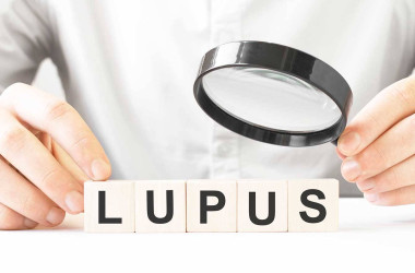 Lupus Hakkında Bilmeniz Gereken Her Şey