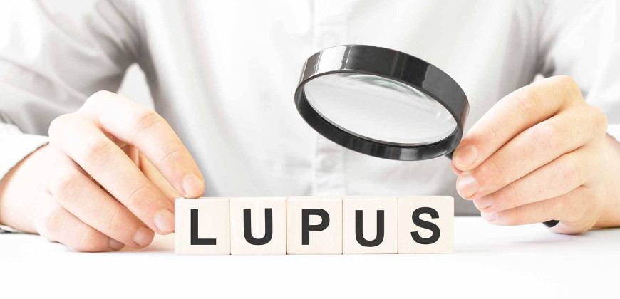 Lupus Hakkında Bilmeniz Gereken Her Şey