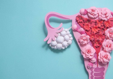 Polikistik Over Sendromu: Semptomlar, Nedenler ve Teşhis