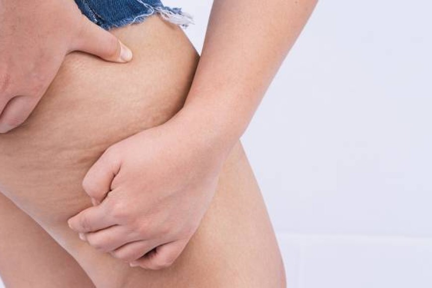 Micro Plus for Cellulite Appearance