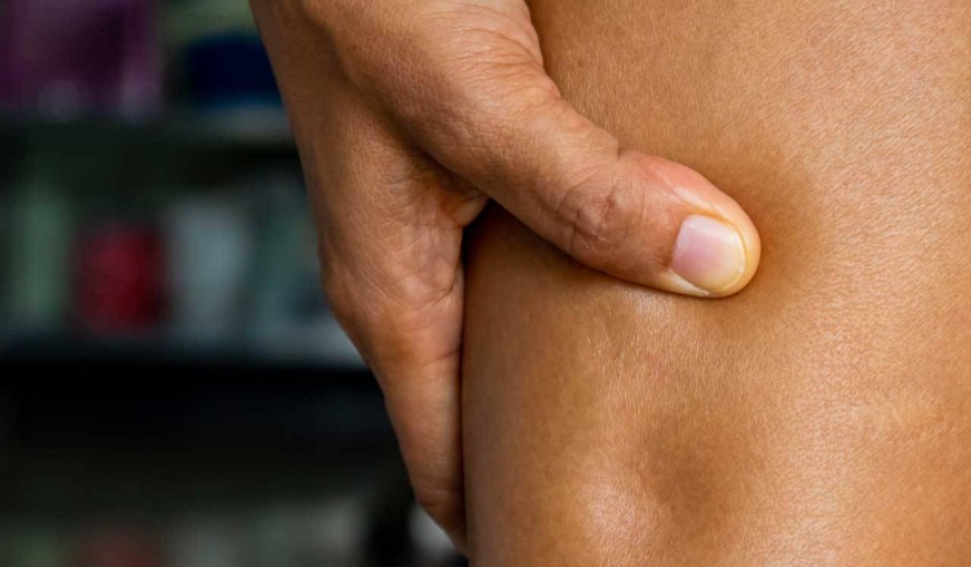 Hızlı Ödem Söktürücü 8 Besin Önerisi